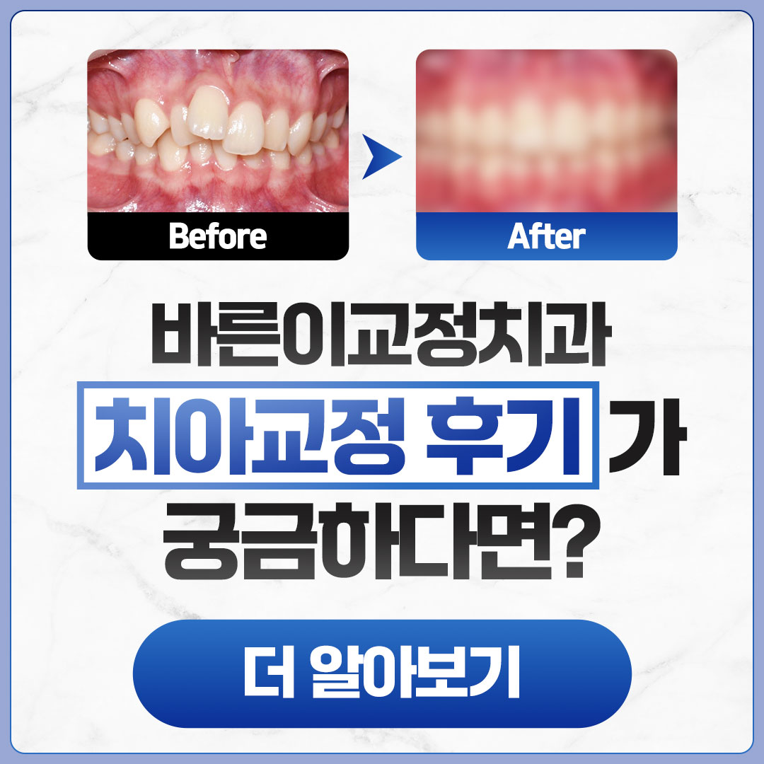 치아교정 골든타임 / 치아교정 골든타임 알아보기